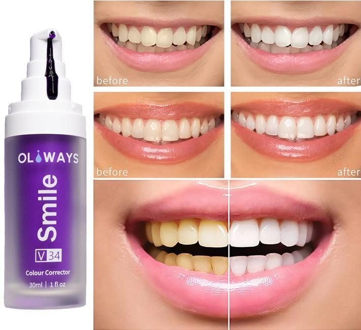 Diş Beyazlatıcı Jel 30 ML Oliways Smile V34 Colour Corrector Anında