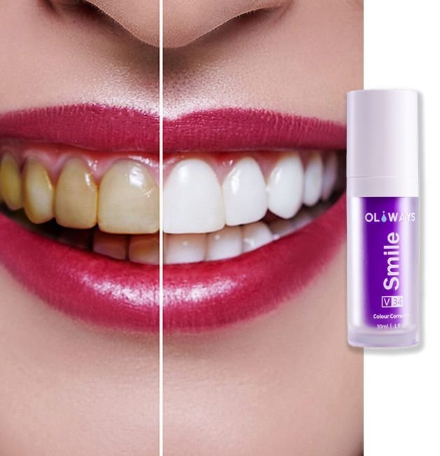 Diş Beyazlatıcı Jel 30 ML Oliways Smile V34 Colour Corrector Anında