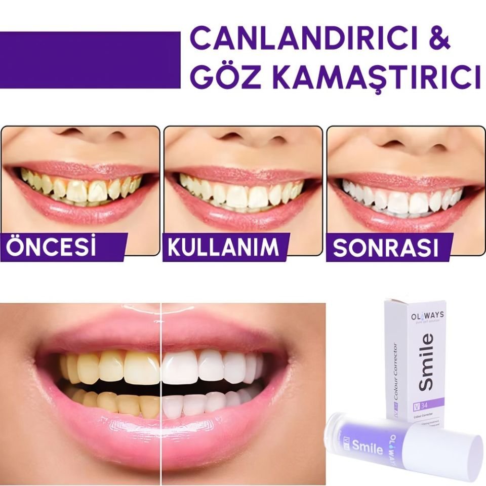 Diş Beyazlatıcı Jel 30 ML Oliways Smile V34 Colour Corrector Anında